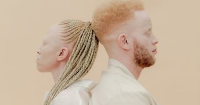 Albinisme au Togo : la lumière enfin faite